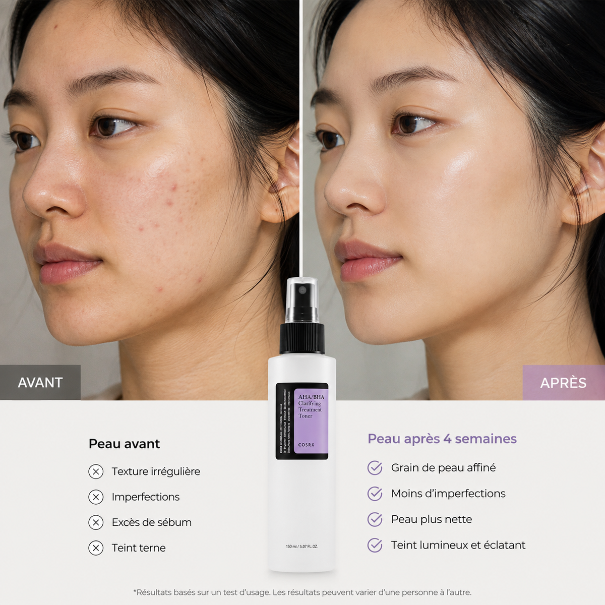 COSRX - Lotion Tonique Exfoliant AHA/BHA, Soin Clarifiant Anti-Imperfections