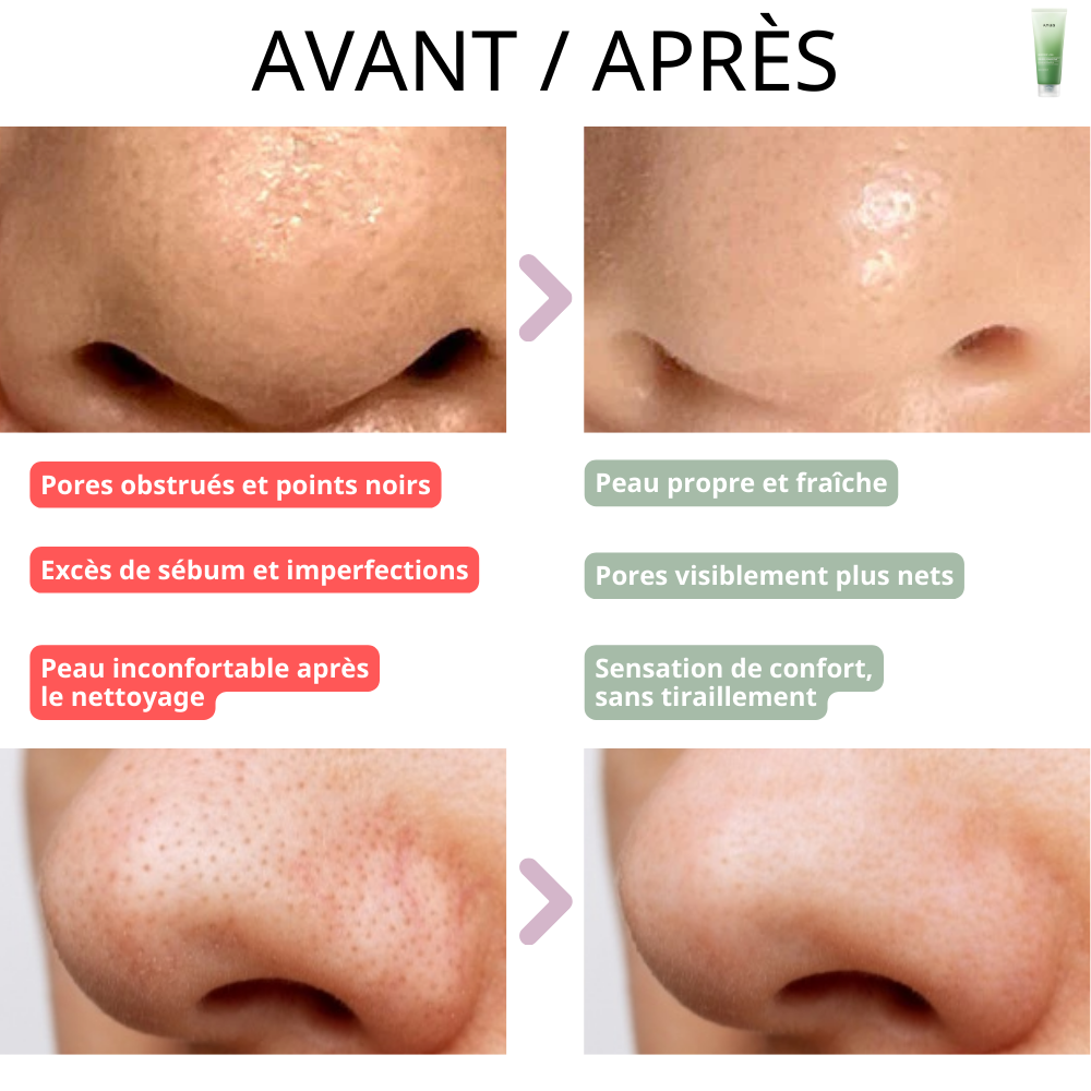 Anua - Mousse Nettoyante Purifiante anti-points noirs à l'Houttuynia Cordata