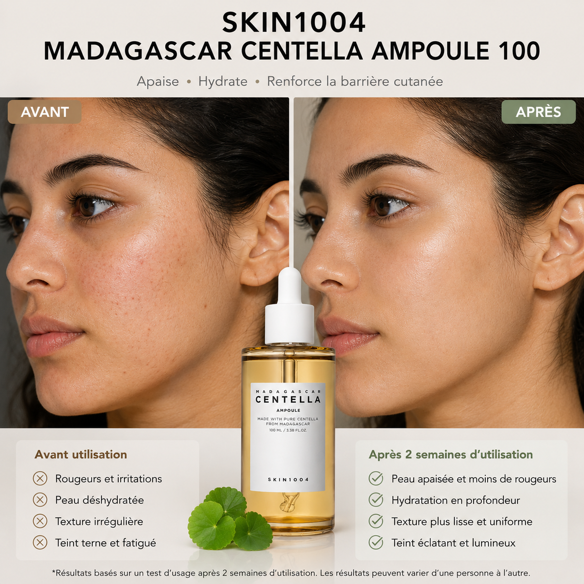 SKIN1004 - Ampoule Apaisante & Hydratante, Centella Asiatica 100%