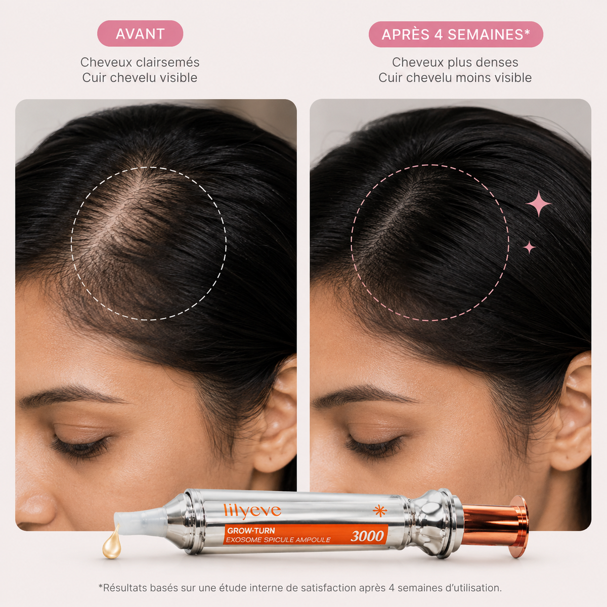 Lilyeve - Sérum Densifiant Anti-Chute aux Exosomes