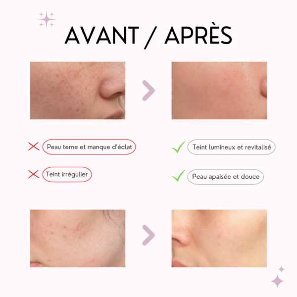 aplb masque anti Âge rétinol, vitamine c & e