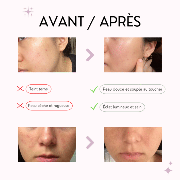 abib masque tissu ph doux au miel – nutrition & Éclat