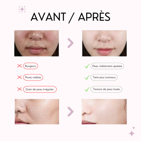 anua masque Éclat à la pêche 70% & niacinamide