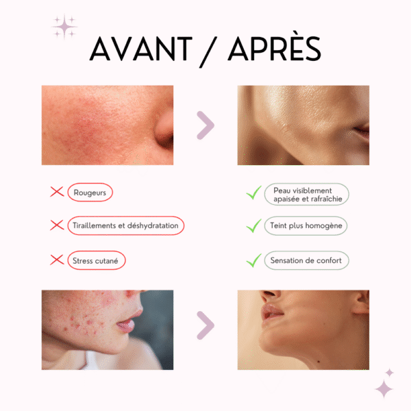 anua masque tissu apaisant heartleaf 77%