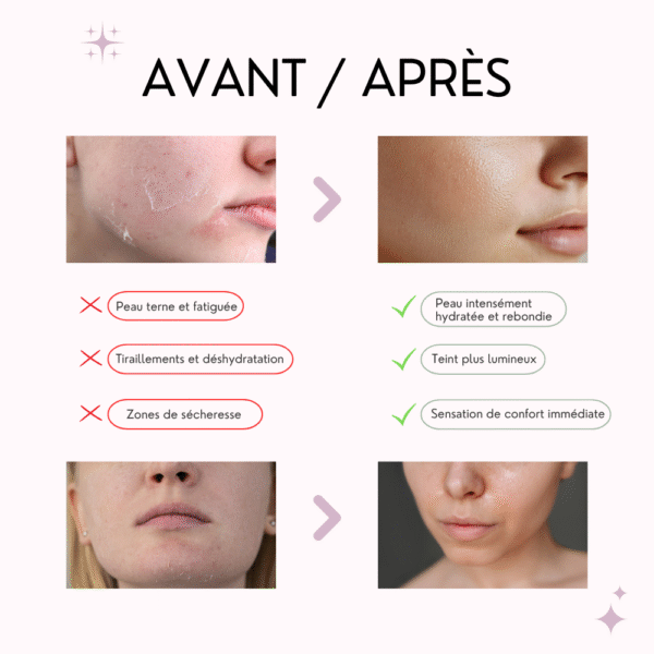 anua masque sérum pdrn & acide hyaluronique