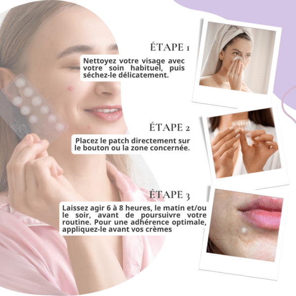 some by mi patch boutons, anti imperfections – 18 patchs