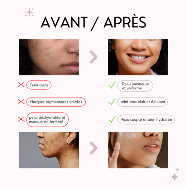 some by mi masque Éclat yuja & niacinamide