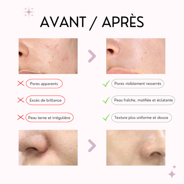 some by mi masque purifiant au thé matcha